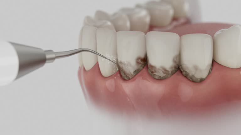 Trusted Wisdom Tooth Removal service in Shannon Hills, AR - Dentist Open Now